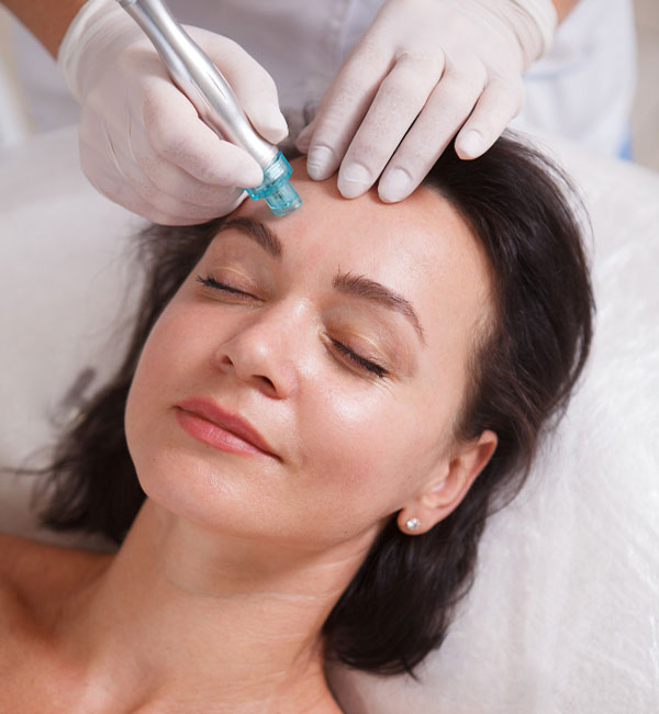 Microneedling
